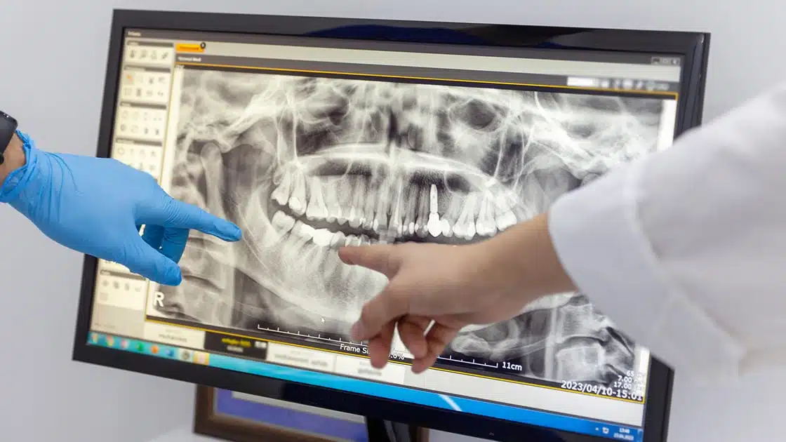 Pre-Prosthetic Procedures