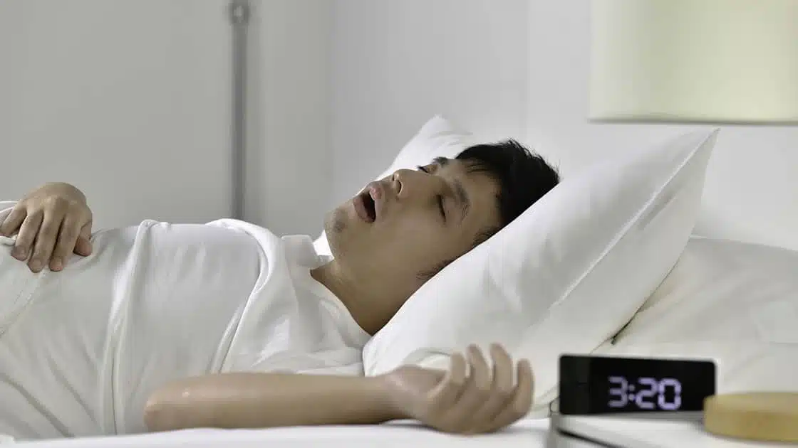 Sleep Apnea Treatment