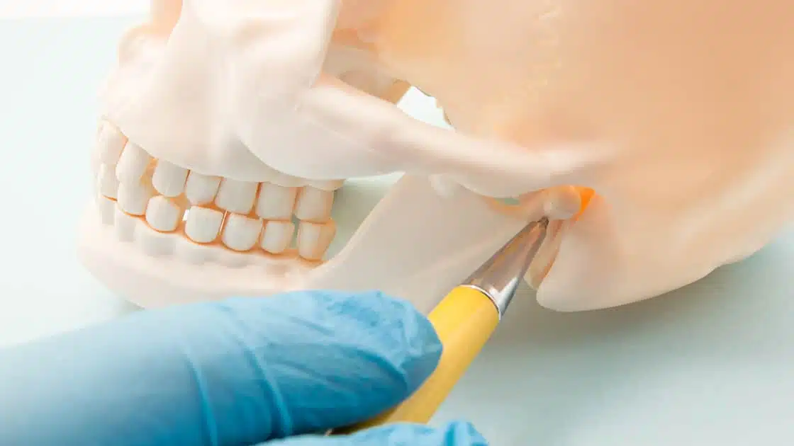 Causes of TMJ Dysfunction
