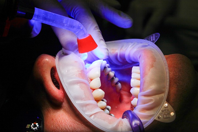 Bone Grafting