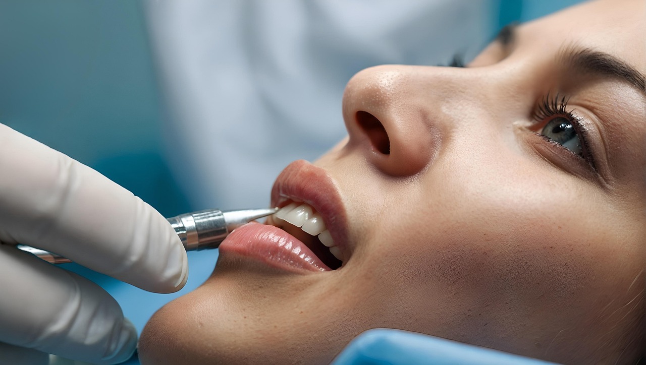 Frenectomy Procedure