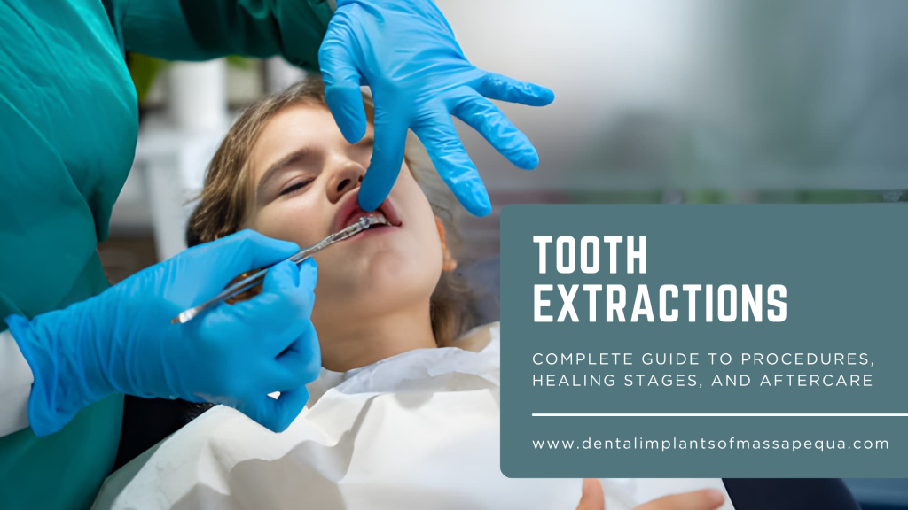 Tooth Extractions