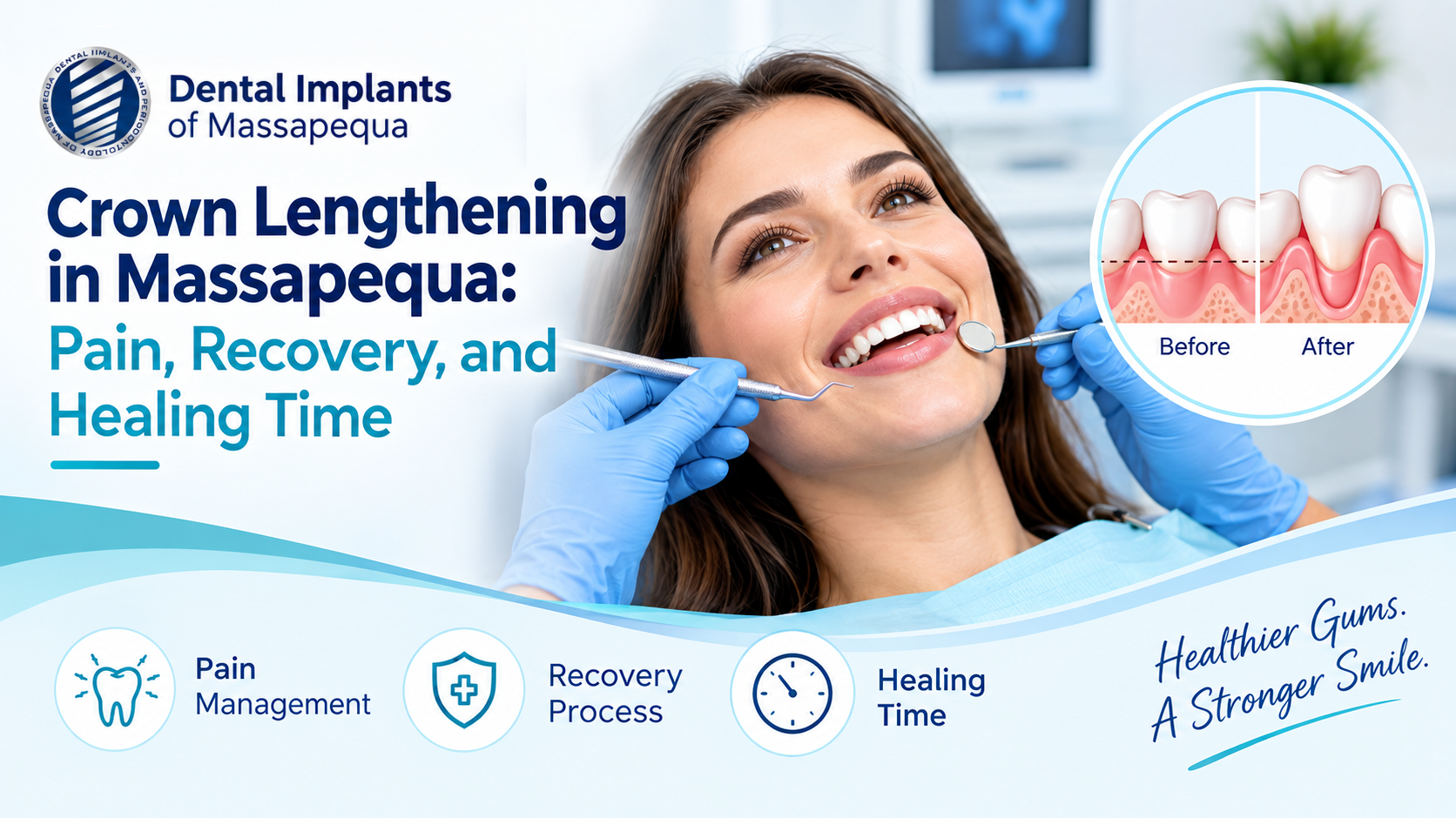 Crown Lengthening in Massapequa